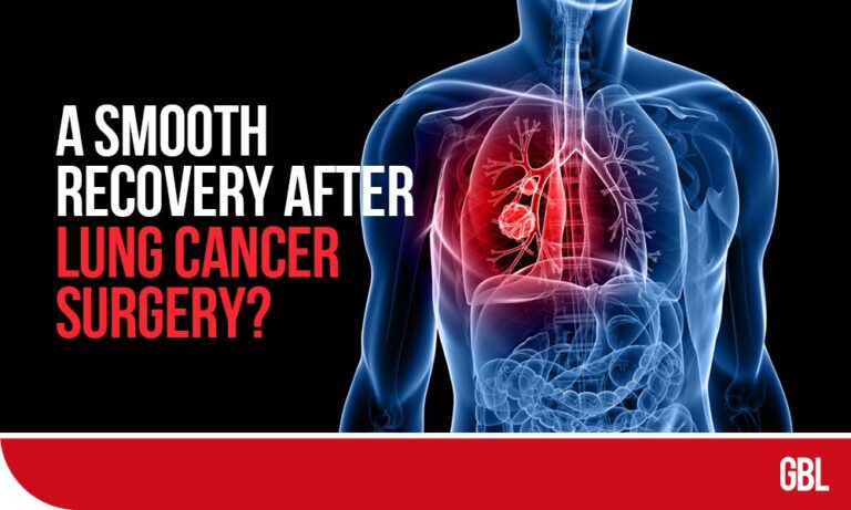 How To Have A Smooth Recovery After Lung Cancer Surgery?